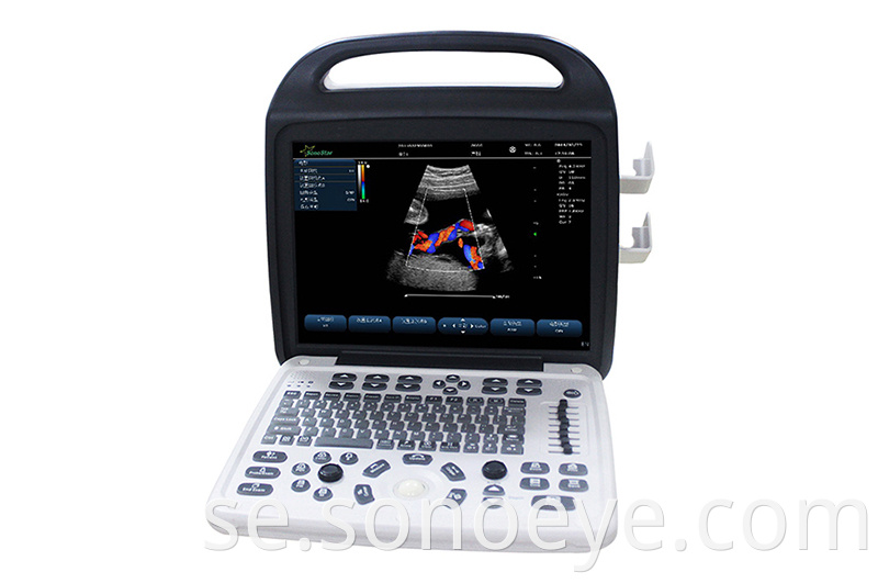 c10 Color Doppler Ultrasound System For Hostipal